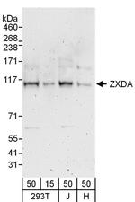 ZXDA/ZXDB Antibody in Western Blot (WB)