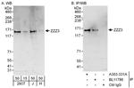 ZZZ3 Antibody in Western Blot (WB)