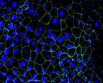 ZO-2 Antibody in Immunocytochemistry (ICC/IF)