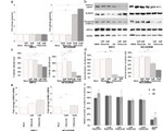 beta Catenin Antibody in Western Blot (WB)