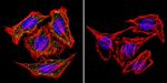 alpha Adaptin Antibody in Immunocytochemistry (ICC/IF)