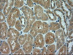 alpha-actinin (Actinin alpha 1) Antibody in Immunohistochemistry (Paraffin) (IHC (P))