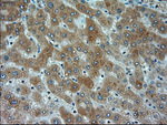 alpha-actinin (Actinin alpha 1) Antibody in Immunohistochemistry (Paraffin) (IHC (P))