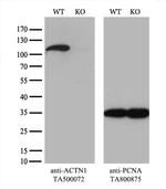 alpha-actinin (Actinin alpha 1) Antibody