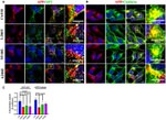 alpha Adaptin Antibody in Immunocytochemistry (ICC/IF)