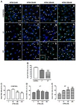 Acetyl-alpha Tubulin (Lys40) Antibody in Immunocytochemistry (ICC/IF)