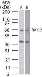 IRAK2 Antibody in Western Blot (WB)