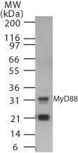 MyD88 Antibody in Western Blot (WB)