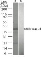 SARS Coronavirus Nucleocapsid Antibody in Western Blot (WB)