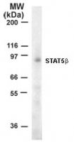 STAT5 beta Antibody in Western Blot (WB)