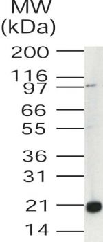 UBE2V1 Antibody in Western Blot (WB)