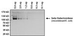 beta Galactosidase Antibody in Western Blot (WB)