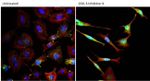 beta Catenin Antibody in Immunocytochemistry (ICC/IF)