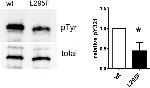 Phospho-HIPK2 (Tyr361) Antibody in Western Blot (WB)