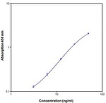 Human Cathepsin L ELISA Kit