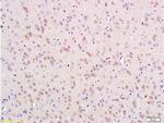 Nestin Antibody in Immunohistochemistry (Paraffin) (IHC (P))