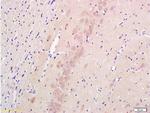 Nestin Antibody in Immunohistochemistry (Paraffin) (IHC (P))