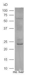 IGF 1 Antibody in Western Blot (WB)