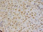 IGF 2 Antibody in Immunohistochemistry (Paraffin) (IHC (P))