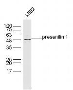 Presenilin 1 Antibody in Western Blot (WB)