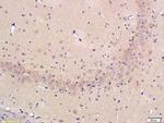 Osteopontin Antibody in Immunohistochemistry (Paraffin) (IHC (P))