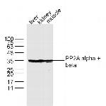 PP2A alpha/beta Antibody in Western Blot (WB)