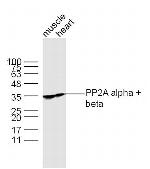 PP2A alpha/beta Antibody in Western Blot (WB)