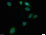 Bcl-2 Antibody in Immunocytochemistry (ICC/IF)