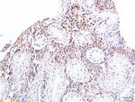 Bcl-2 Antibody in Immunohistochemistry (Paraffin) (IHC (P))