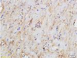 Bcl-2 Antibody in Immunohistochemistry (Paraffin) (IHC (P))