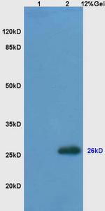 Bcl-2 Antibody in Western Blot (WB)