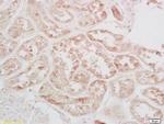 Phospho-CREB-1 (Ser133) Antibody in Immunohistochemistry (Paraffin) (IHC (P))