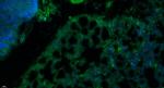 Insulin Receptor alpha Antibody in Immunohistochemistry (Paraffin) (IHC (P))