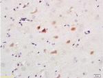 Caspase 9 Antibody in Immunohistochemistry (Paraffin) (IHC (P))