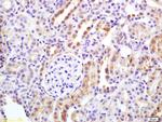 APAF1CT Antibody in Immunohistochemistry (Paraffin) (IHC (P))