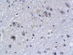 APAF1NT Antibody in Immunohistochemistry (Paraffin) (IHC (P))