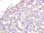 APAF1NT Antibody in Immunohistochemistry (Paraffin) (IHC (P))