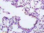 APAF1NT Antibody in Immunohistochemistry (Paraffin) (IHC (P))