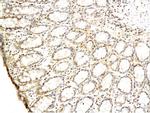 TGF alpha Antibody in Immunohistochemistry (Paraffin) (IHC (P))