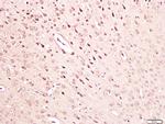 NGF beta Antibody in Immunohistochemistry (Paraffin) (IHC (P))