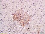 Caspase-3 Antibody in Immunohistochemistry (Paraffin) (IHC (P))