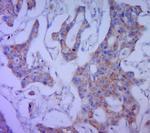 CA125 Antibody in Immunohistochemistry (Paraffin) (IHC (P))