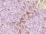 alpha 1 Antitrypsin Antibody in Immunohistochemistry (Paraffin) (IHC (P))