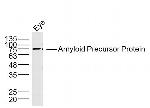 Amyloid Precursor Protein Antibody in Western Blot (WB)