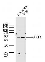 AKT1/2/3 Antibody in Western Blot (WB)