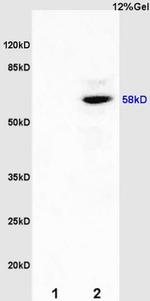 Estrogen receptor beta Antibody in Western Blot (WB)