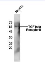 TGF beta Receptor 2 Antibody in Western Blot (WB)