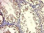 Androgen receptor Antibody in Immunohistochemistry (Paraffin) (IHC (P))