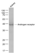 Androgen receptor Antibody in Western Blot (WB)