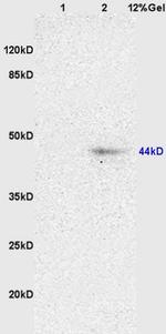 Neurokinin A Receptor Antibody in Western Blot (WB)